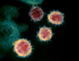 coronavirus-and-diabetes-pic2